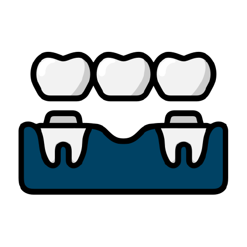 services [Recovered]_dental bridges