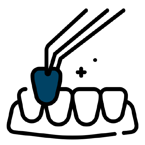 services [Recovered]_dental veneers