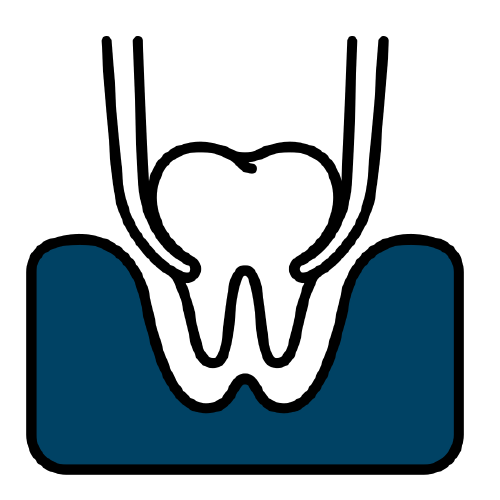 services [Recovered]_tooth extraction